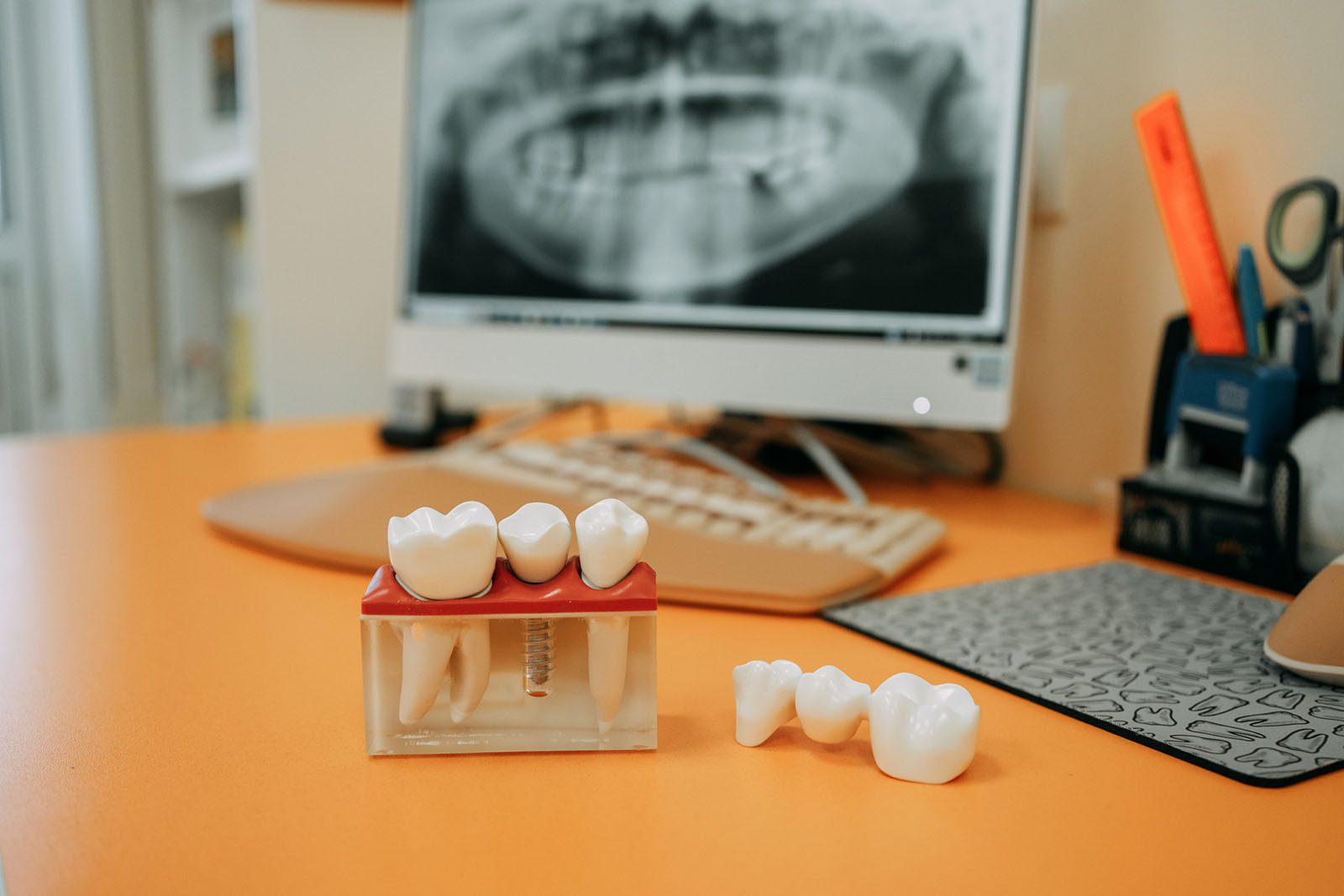 A dental office desk with tooth models and a computer displaying a dental X-ray image in the background.
